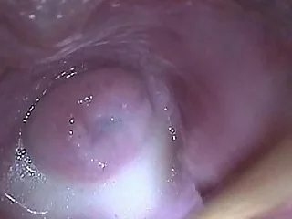 Stick in Baby batter Jizz in Cervix Not far from..